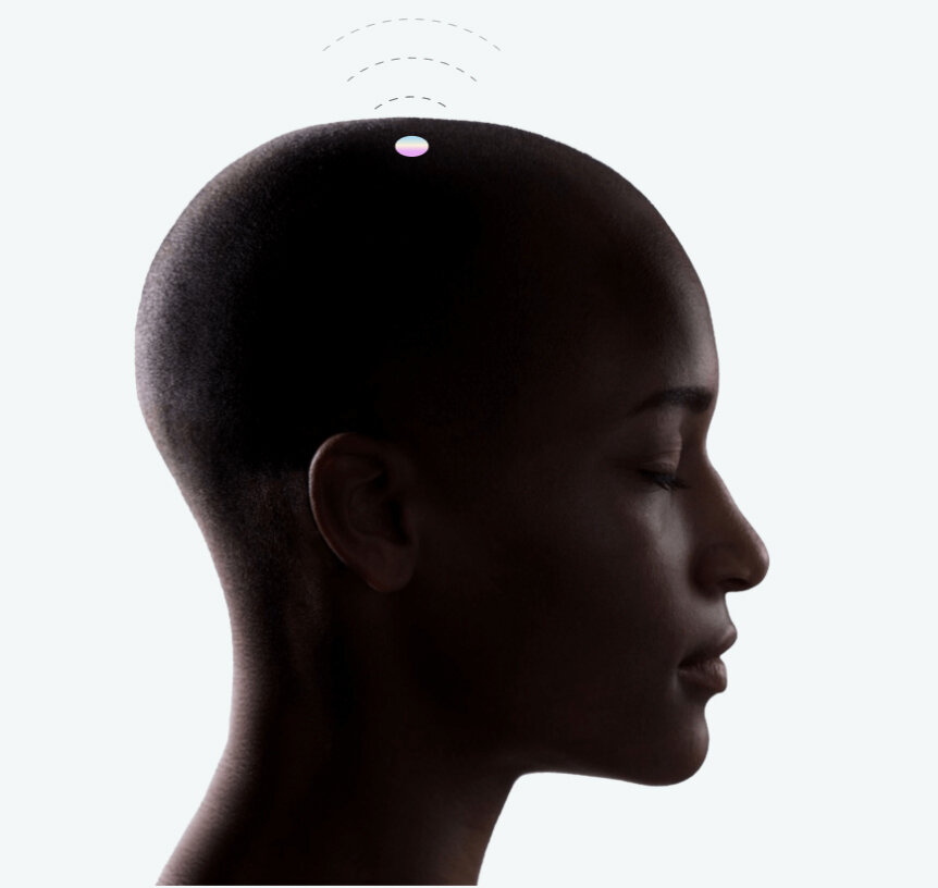 Источник фото: https://neuralink.com/approach/ 