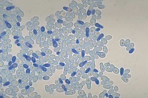 Грибок малоссезия под микроскопом.