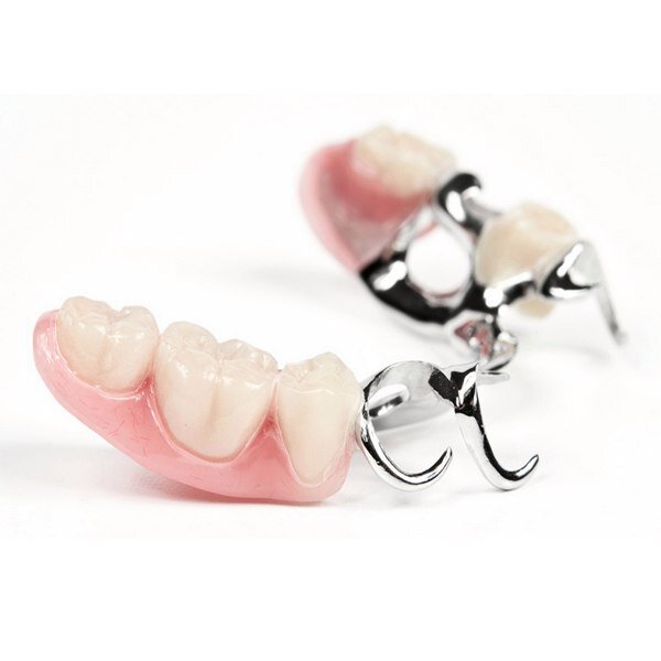 Данный вид протеза обычно ставят при наличии противопоказаний к протезированию на имплантах. Протезирование на имплантатах является уже более прогрессивным методом восстановления. Имеет более долгий срок службы и более комфортно для пациента, так как не содержит съемных конструкций.

Бюгельные протез также являются более бюджетным способом восстановления.