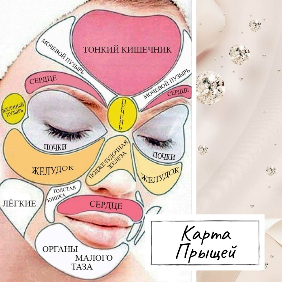 Карта прыщей на лице — как применять | Evolutis Clinic | Дзен