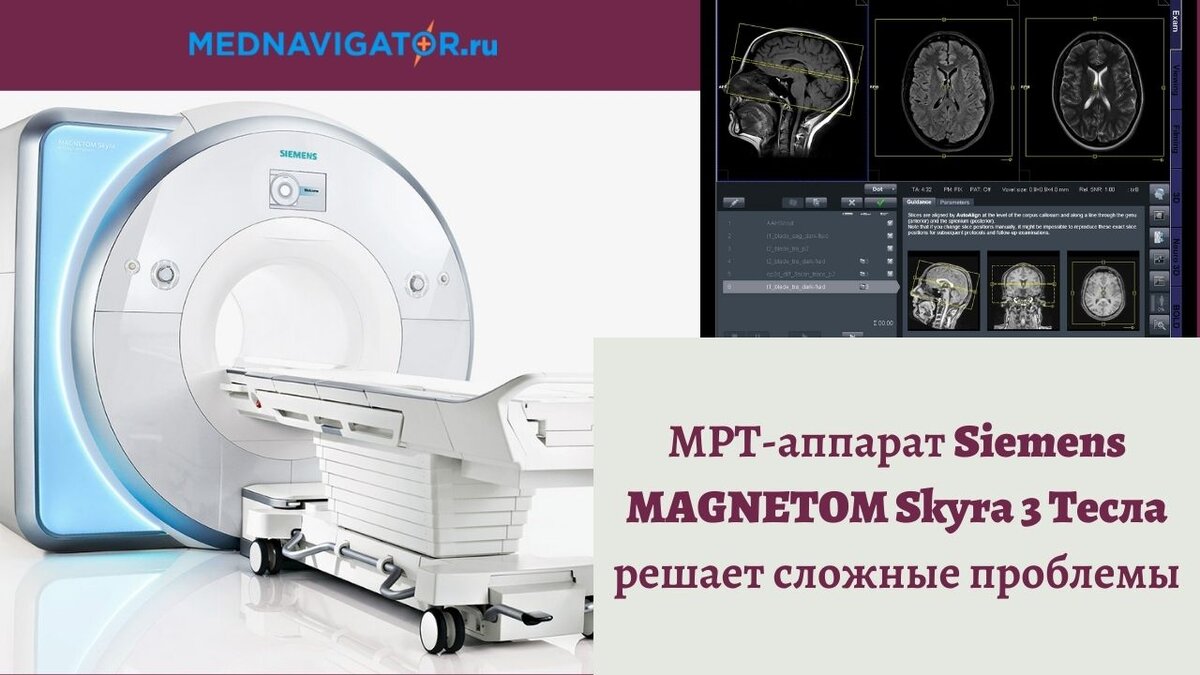 Магнитно-резонансный томограф 3 Тесла, который решает 3 проблемы МРТ |  Mednavigator.ru | Дзен