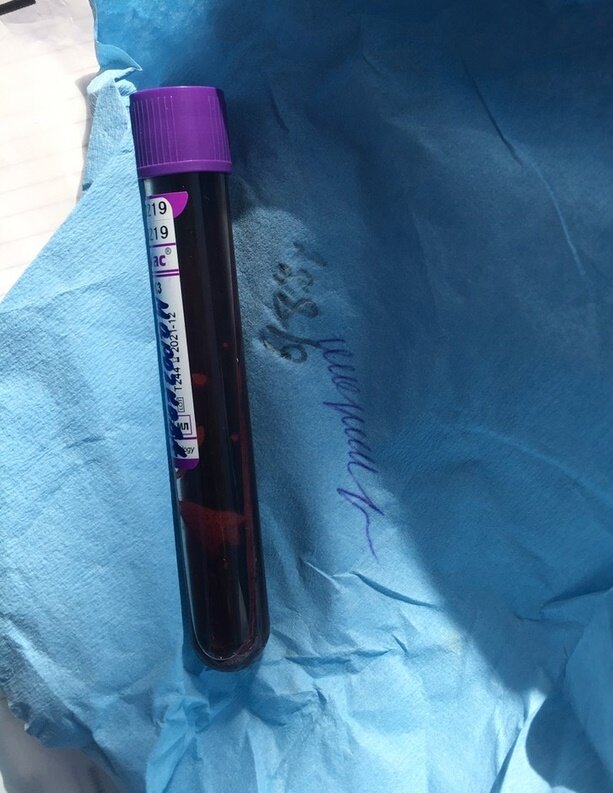 Фото из личного архива. Кстати, кровушка в пробирке моя)