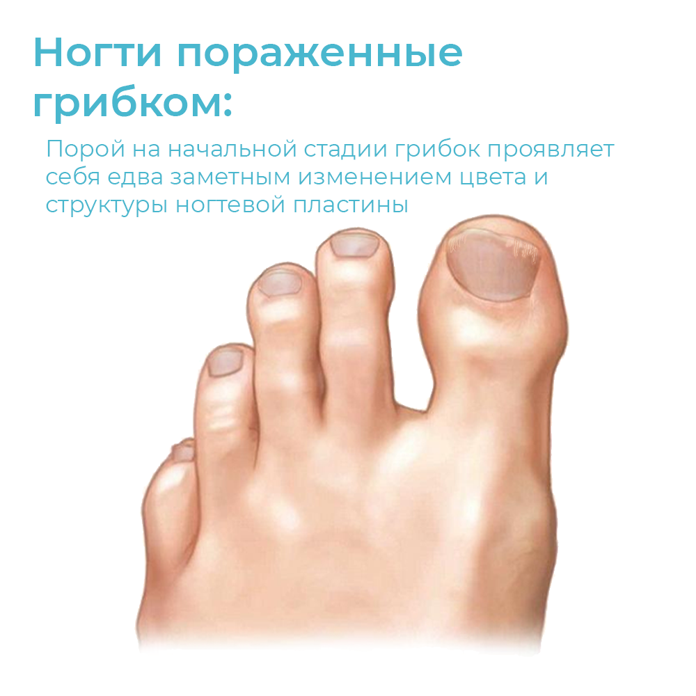Микология и подология - Медицинский Центр Дерматологии
