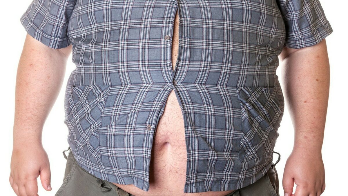 Ожирение - основная причина возникновения сахарного диабета 2 типа.