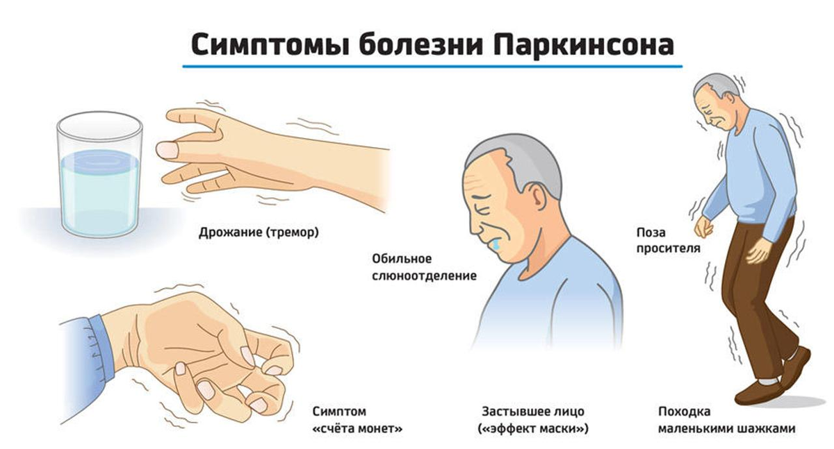 Б паркинсона лечение. Синдром Паркинсона симптомы. Клинические синдромы при болезни Паркинсона. Болезнь Паркинсона симптомы и признаки у пожилых. Паркинсонизм и болезнь Паркинсона симптомы.