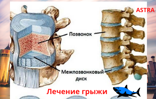 Решение проблем с помощью акульего жира, листайте картинки 