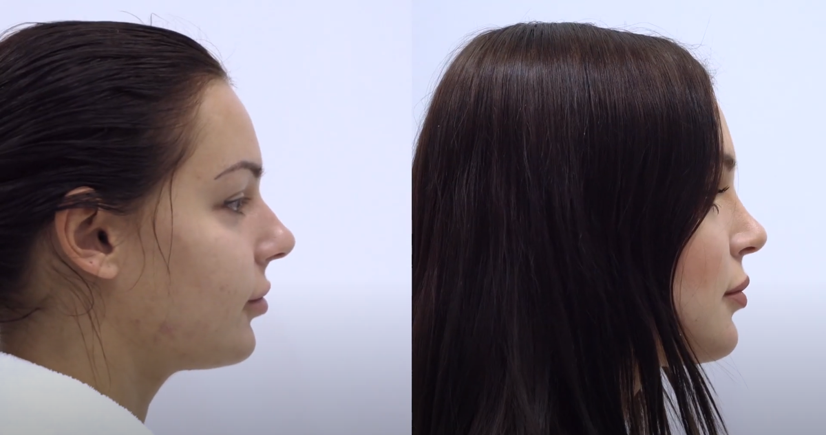 До и после операции