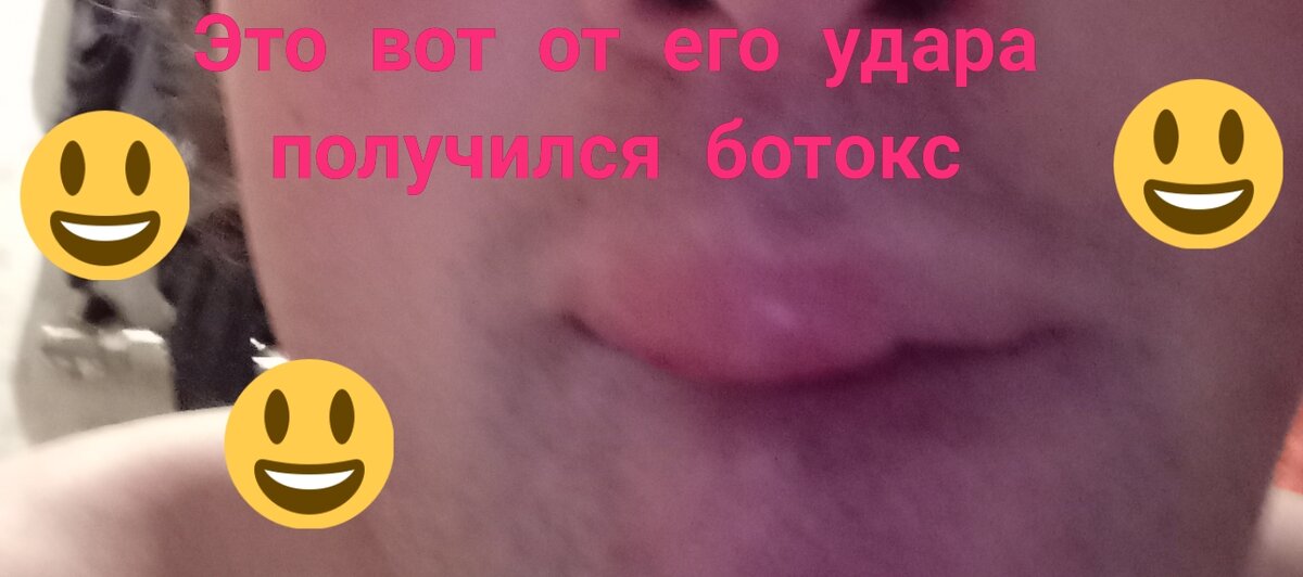 Это такое бывает. 