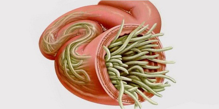 Стоковые фотографии по запросу Аскарида