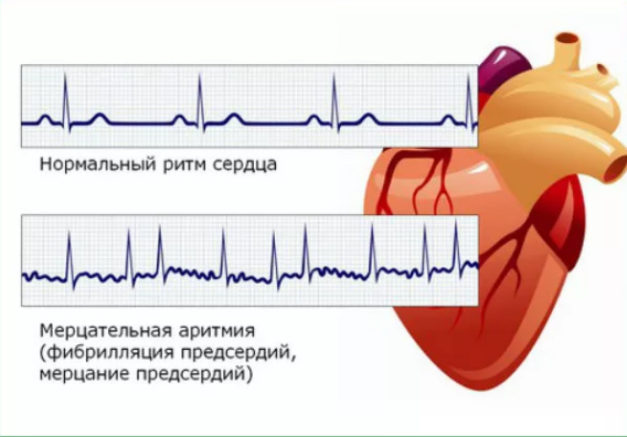 Картинка из интернета. Теперь все понятно