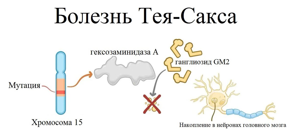 Рисунок 2. Схема болезни Тея-Сакса. 