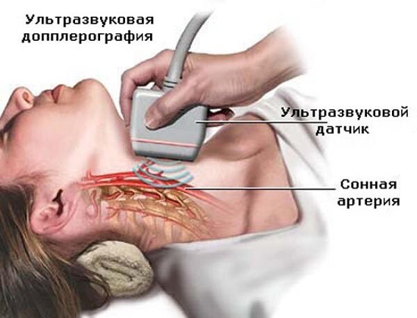 УЗИ сердца и сосудов шеи - для чего делать и что показывает