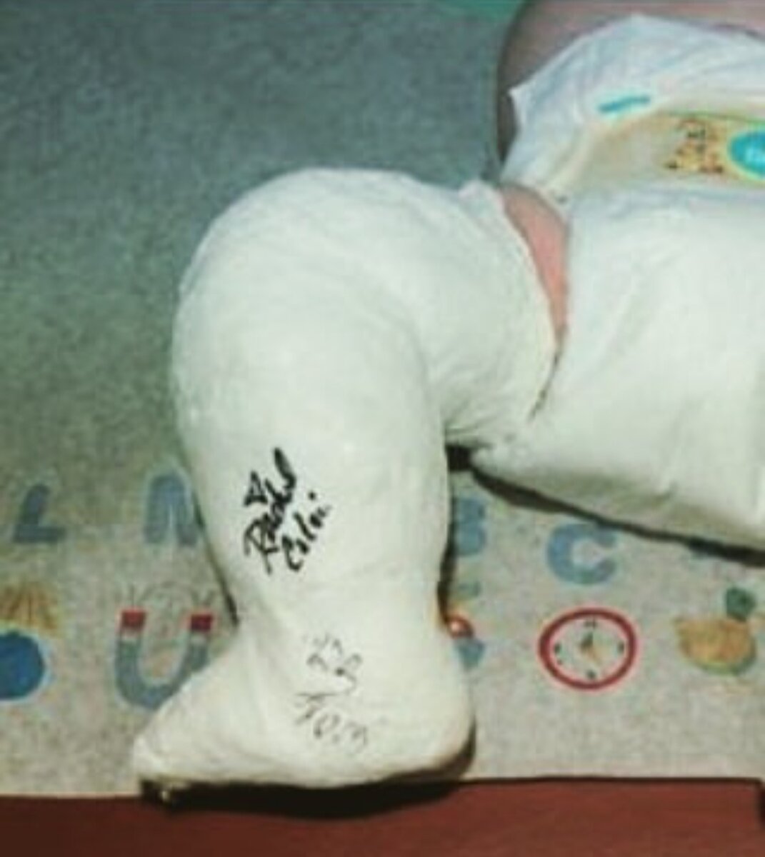 Нет, нет, это -не наш гипс🤣.
Наш лежит у моей мамы дома. Мы его подарим Анютке на 18 лет в рамке🎂🎁🎊🎉.....Наверное......если не рассыпется до этого времени⏰⏳.