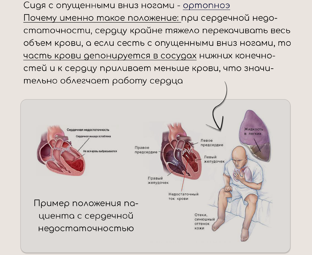 Вынужденные положения пациента | Александр Сеченов из медицинской онлайн  школы - Sechenov Universkill | Дзен