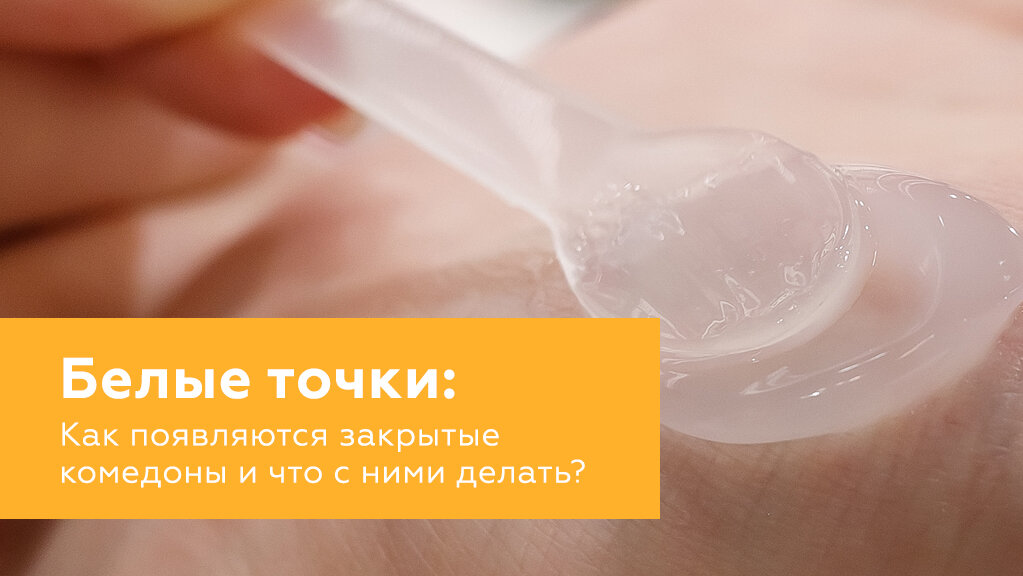 Как избавиться от закрытых комедонов? | Korea Market | Дзен