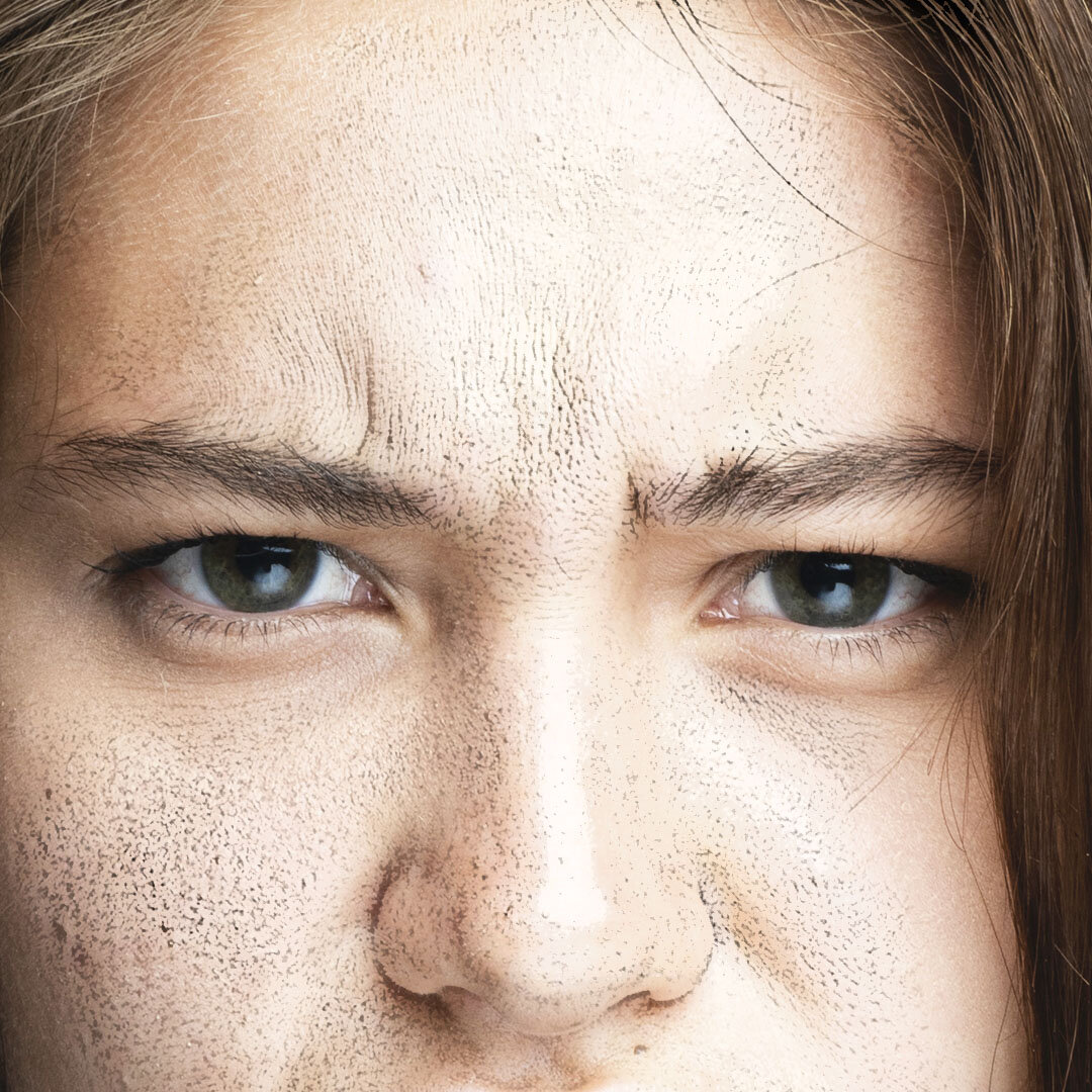 Стресс и недостаток сна вредны для кожи