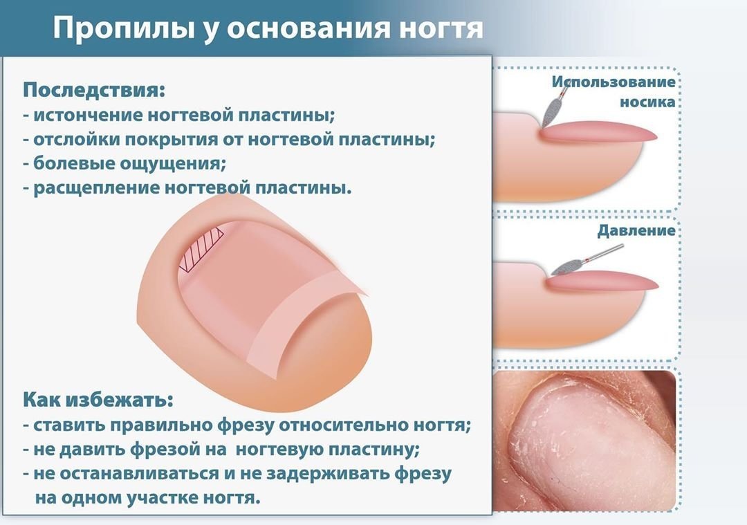 Важные правила для работы фрезой «пламя»