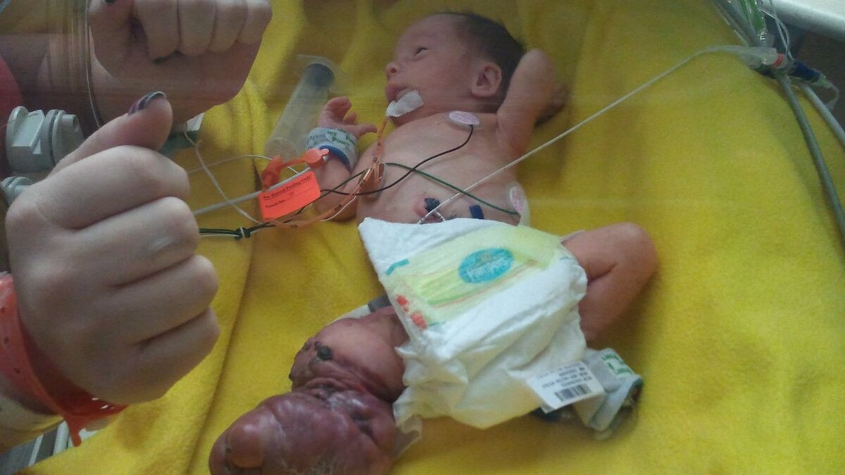 https://edition.cnn.com/2012/03/14/health/medical-mystery-brantley/index.html