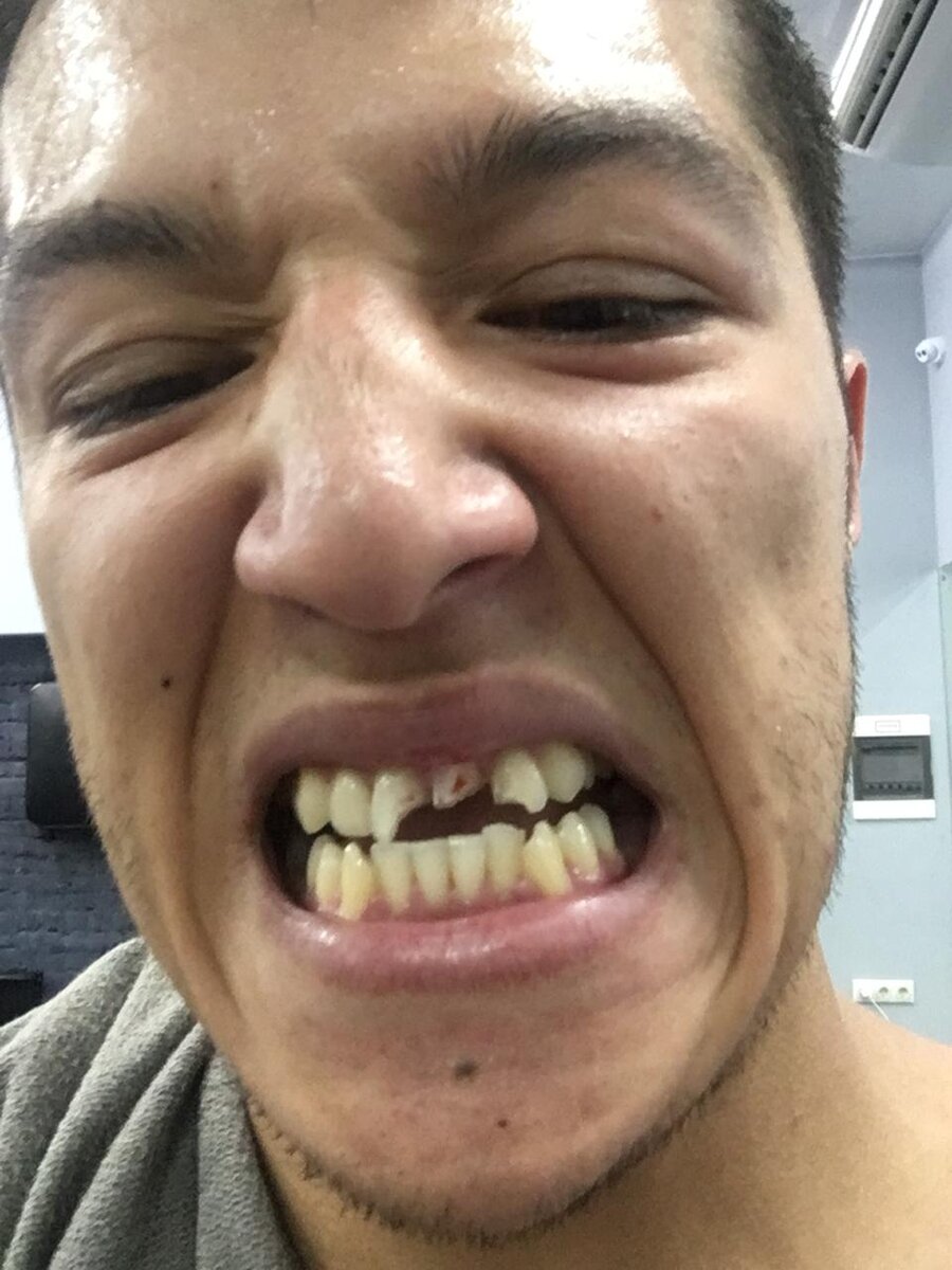 Когда на спарринг не одел капу и переоценил себя👊💥😉