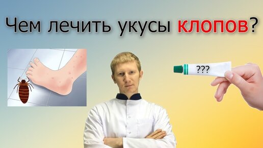 Средства для лечения укусов клопов