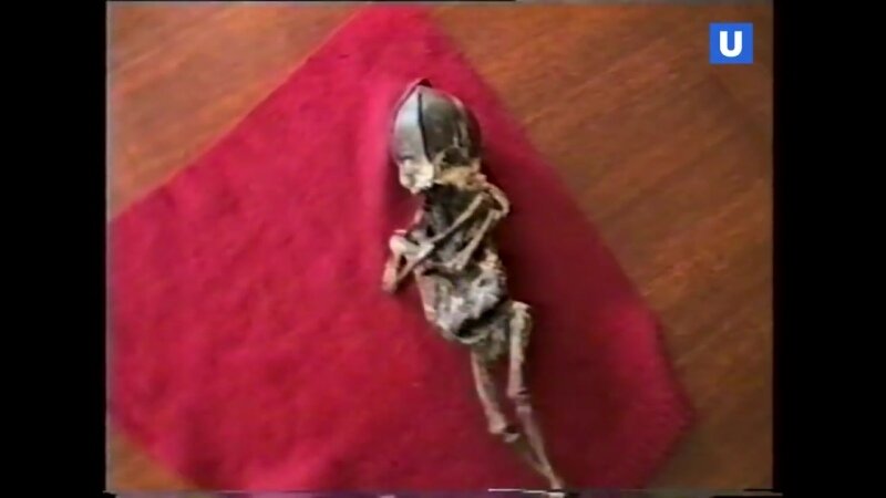 Мумифицированные останки Кыштымского Карлика (Алёшеньки).