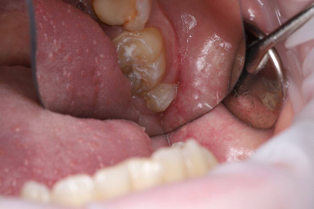 Нужно ли утилизировать зубы как биологический материал?