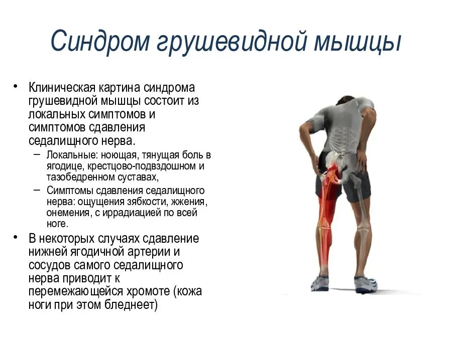 Здесь вся нога отмечена красным, но это когда уже сильно страдает седалищный нерв - он может давать симптоматику вплоть до кончиков пальцев