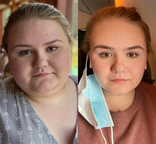 Большие девочки после проекта как изменились фото Pin oleh Grace Valentine di Before & Afters