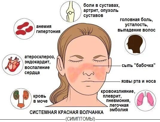 Лепра - симптомы и методы лечения — Евромедклиник 24