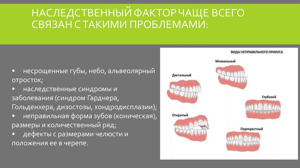 Перекрестный прикус схема