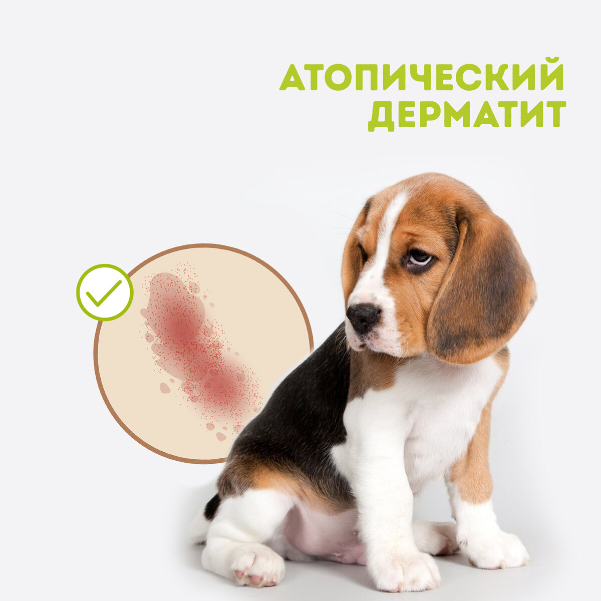 Атопический дерматит (АтД)