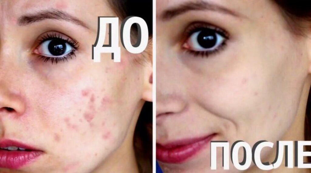 фото взято из открытых источников 