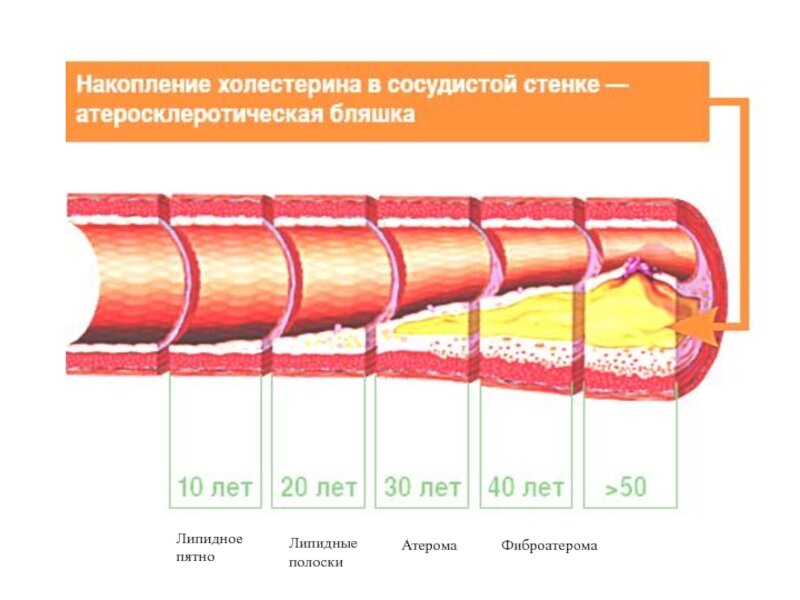 Имбибиция сосудистой стенки