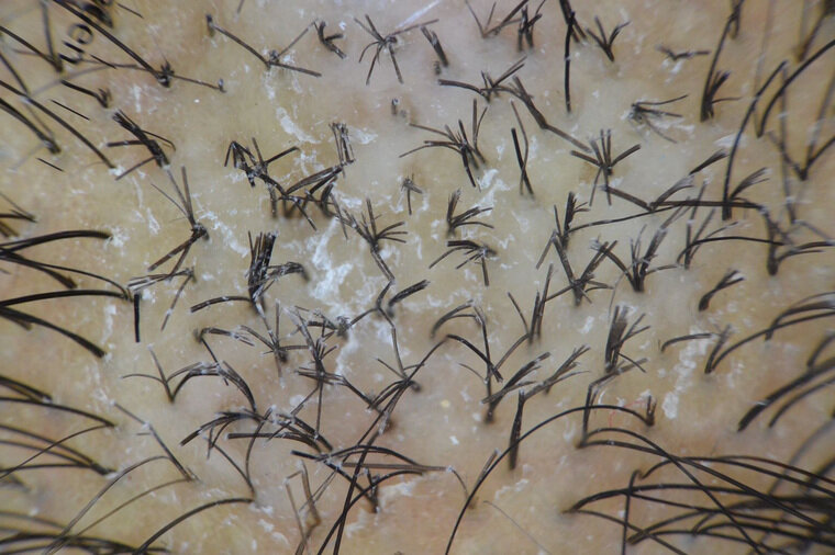    Из-за травмирования волосы ломаются