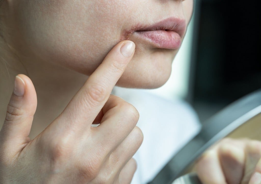 Фото: shutterstock