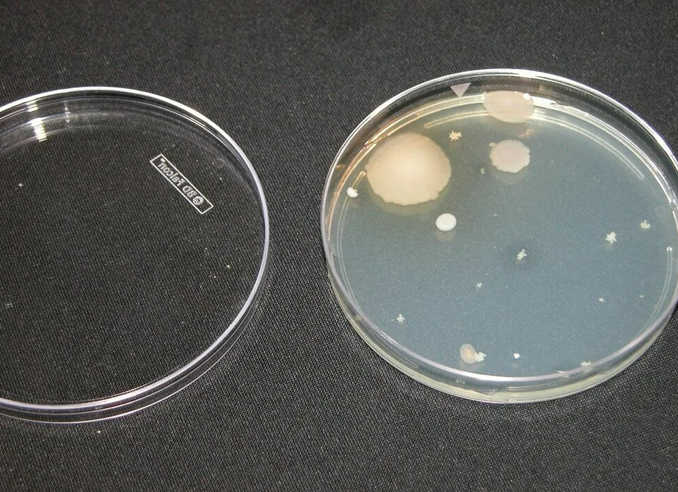 Совокупность микроорганизмов выросших на питательной среде. Чашка Петри с агаром. Агар агар в чашке Петри. Колонии бактерий в чашке Петри. Чашка Петри с бактериями.