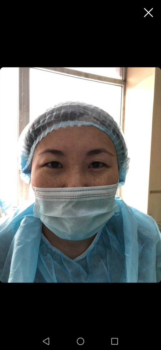 Фото из личного архива. До процедуры. 