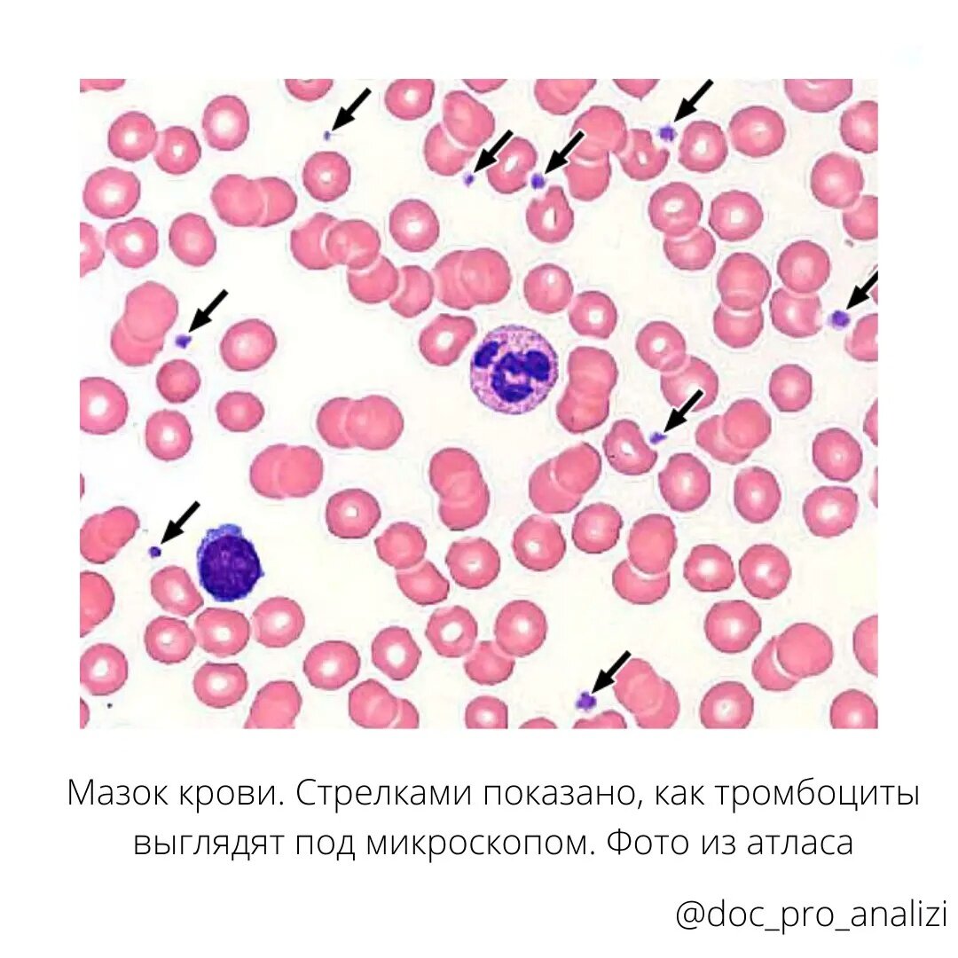 У новорожденных кровь свертывается иначе, чем у взрослых