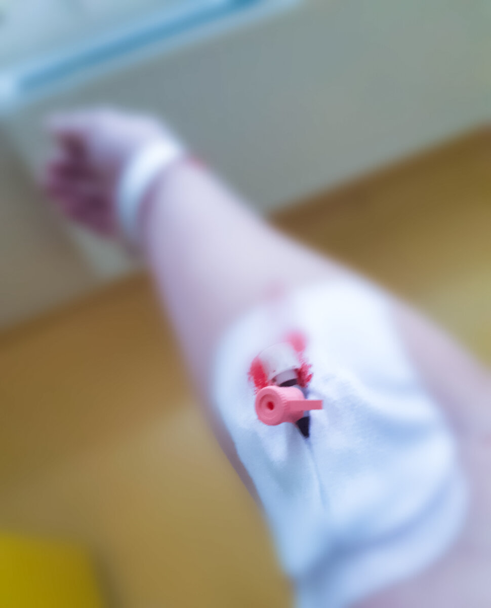 Мне его поставили ещё при поступлении в дородовое отделение, а сняли на 4й день в ПИТе 