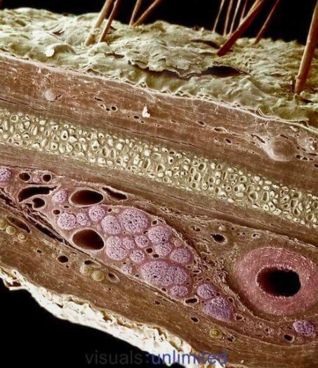 Кожа под микроскопом. Фото с Yandex.ru