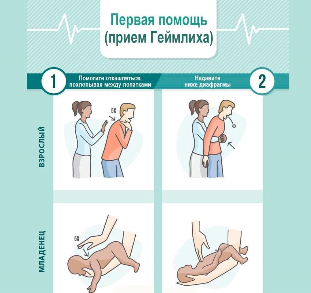 Как выполнять приём Геймлиха в 6 различных ситуациях | «iDeaWay» - быть  лучше каждый день! ✓ | Дзен