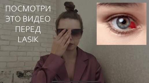 ПОСМОТРИ ЭТО ВИДЕО ЕСЛИ ХОЧЕШЬ LASIK | Лазерная коррекция зрения