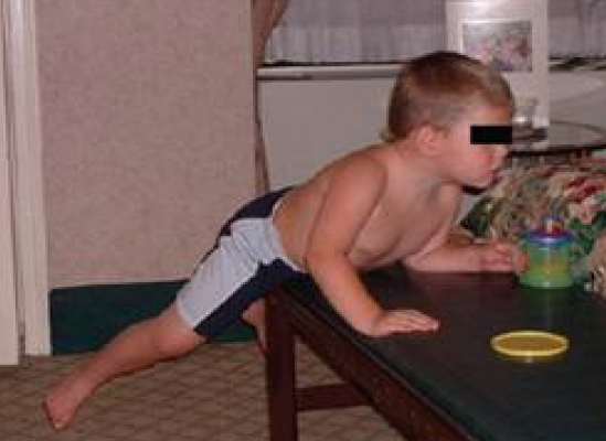 Ребенок опирается животом на мебель и др.предметы