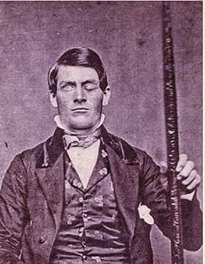 Фото Финеаса Гейджа