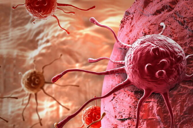 В последние десятилетия в онкологии наблюдается бурный рост исследований и поиска способов лечения, помимо традиционных методик появляются новые способы борьбы с этим опасным заболеванием. И если пару десятилетий назад такие слова, как «рак» и «приговор» были практически синонимами, сегодня многие онкологические заболевания успешно лечатся.