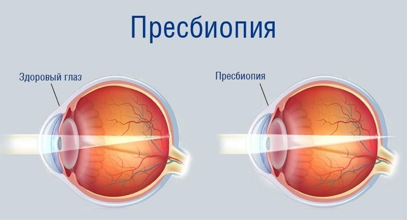  Вот такие незаметные, на первый взгляд, изменения
