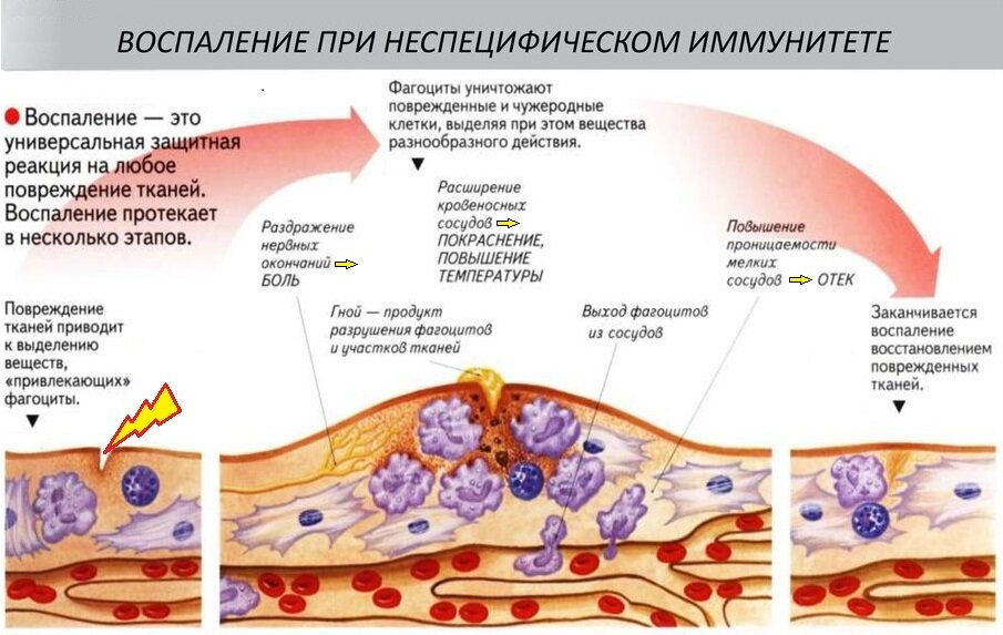 Воспаление картинки для презентации