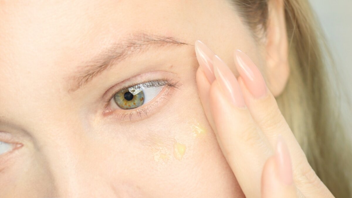 Использую сыворотку с ретинолом на все лицо и даже на веки