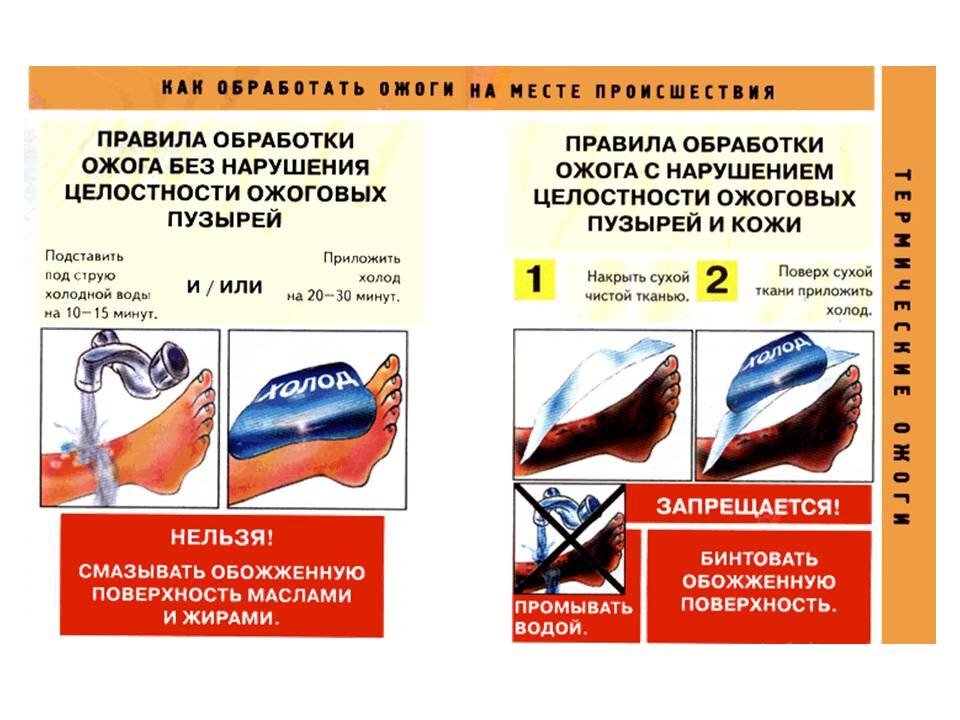 Оказание при термическом ожоге. Правила обработки ожогас напушением уелостности. Правило обработки ожога без нарушения целостности ожоговых пузырей. Первая помощь при ожогах на производстве. Правила обработки ожога с нарушением целостности ожоговых.