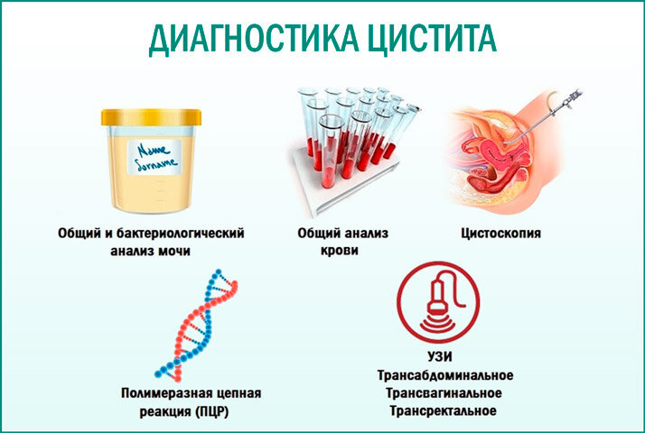 Как быстро снять цистит